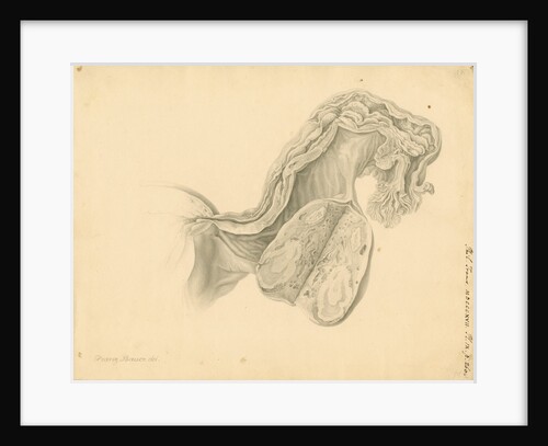 Human ovary by Franz Andreas Bauer