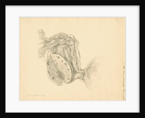 Human ovary by Franz Andreas Bauer