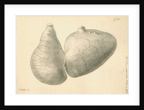 Human stomach by William Clift