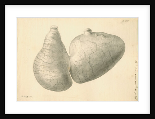 Human stomach by William Clift