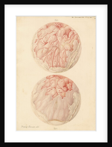 Superficial sore on a human leg by Franz Andreas Bauer