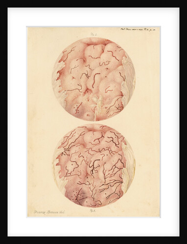Superficial sore on a human leg by Franz Andreas Bauer