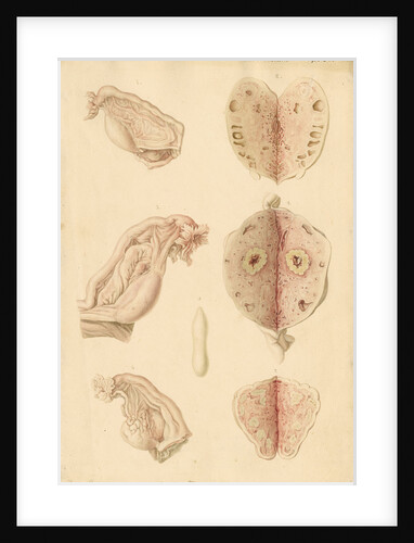 Human ovary and corpus luteum at different ages by Franz Andreas Bauer