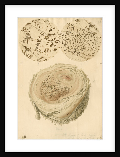 Coagulated human blood and crystals by Franz Andreas Bauer