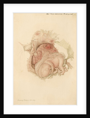 An unborn child by Franz Andreas Bauer