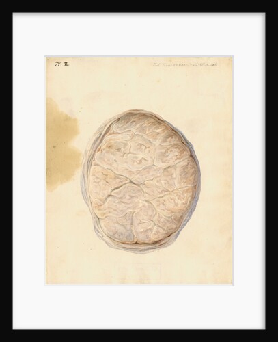 Human placenta by William Clift