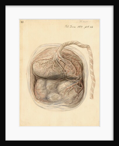 Monkey placenta by William Clift