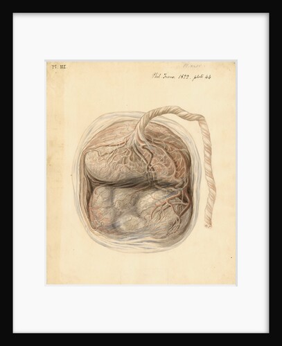 Monkey placenta by William Clift