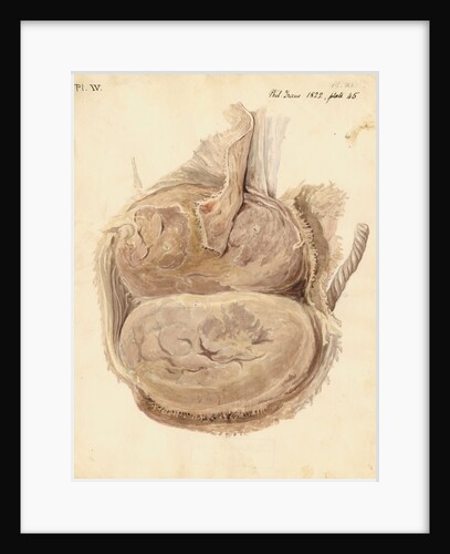 Monkey placenta by William Clift