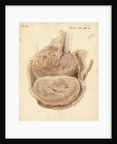 Monkey placenta by William Clift