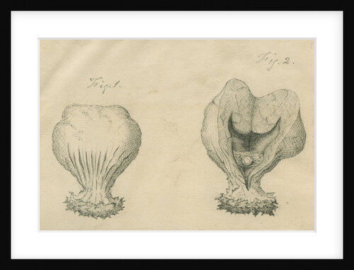 Surgically removed tumour by Caleb Burrell Rose