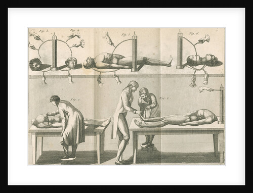 Aldini's galvanic experiments by G.M.