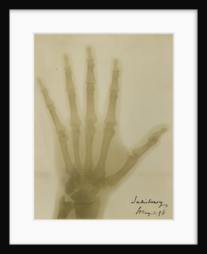 X-ray photograph of the hand of Robert Arthur Talbot Gascoyne-Cecil by Alan Archibald Campbell Swinton