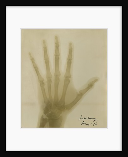 X-ray photograph of the hand of Robert Arthur Talbot Gascoyne-Cecil by Alan Archibald Campbell Swinton