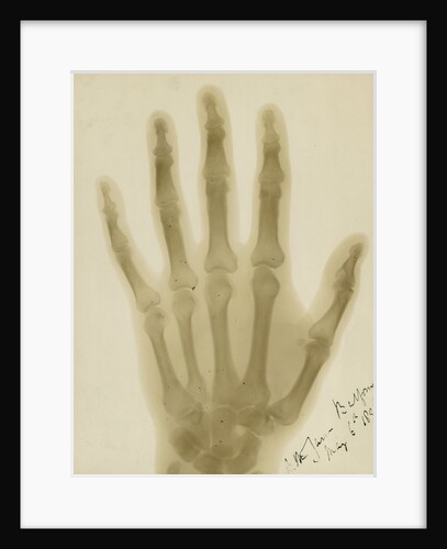 X-ray photograph of the hand of Arthur James Balfour by Alan Archibald Campbell Swinton