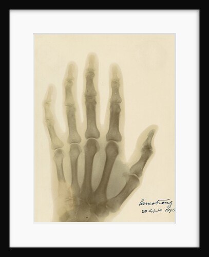 X-ray photograph of the hand of William George Armstrong by Alan Archibald Campbell Swinton