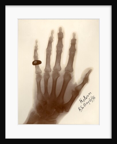 X-ray photograph of the hand of William Thomson by Alan Archibald Campbell Swinton