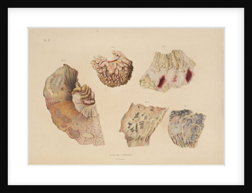 Effect of cholera on the small intestine by d'Harlingue