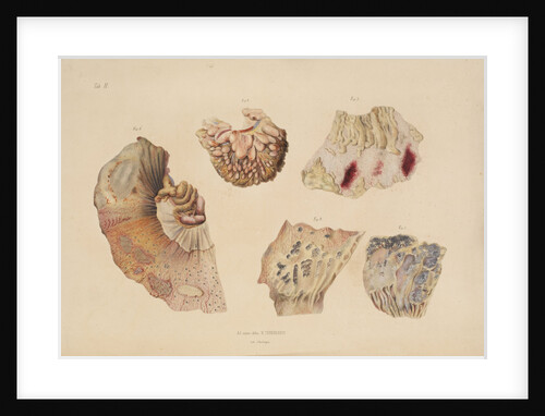 Effect of cholera on the small intestine by d'Harlingue