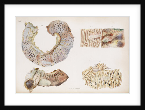 Effects of cholera on the ileum by d'Harlingue
