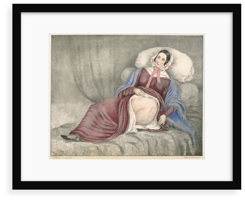Portrait of Elizabeth Powis showing a leg amputation by Leonard