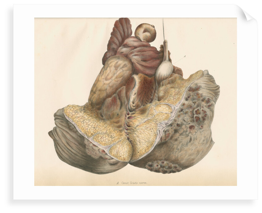'Great Sciatic nerve' by Leonard