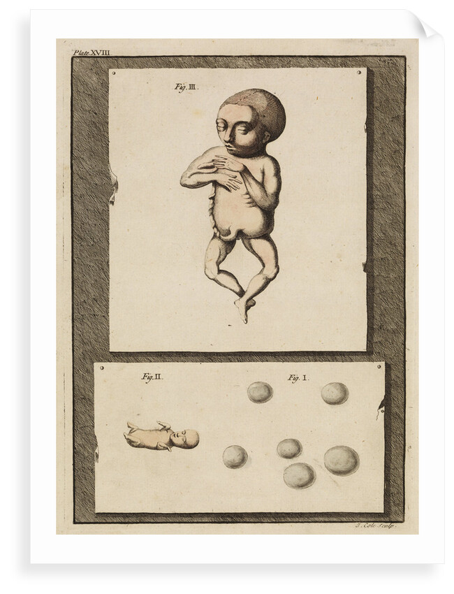 Human eggs and foetuses by T Cole