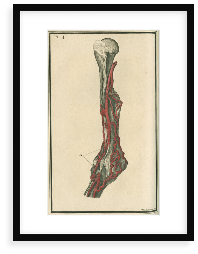 Dissection of an arm on which the operation for the Aneurism had been performed by unknown