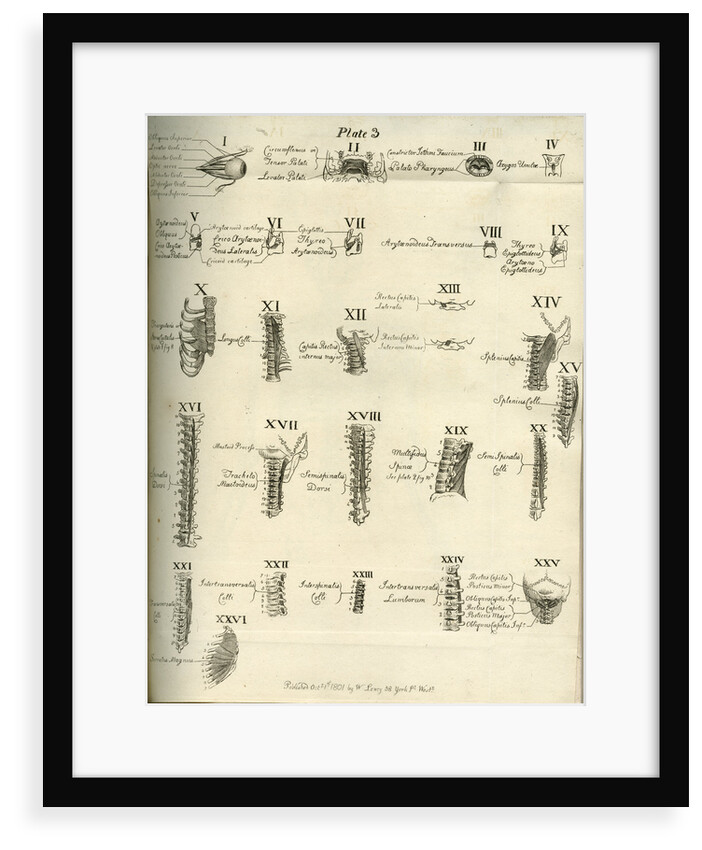 Muscles of the human head, neck and spine by Joseph Constantine Carpue