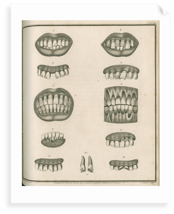 Irregularities of the teeth by Parks