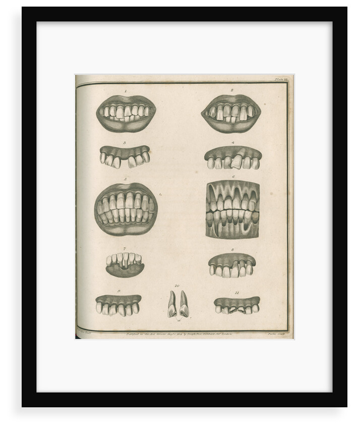 Irregularities of the teeth by Parks