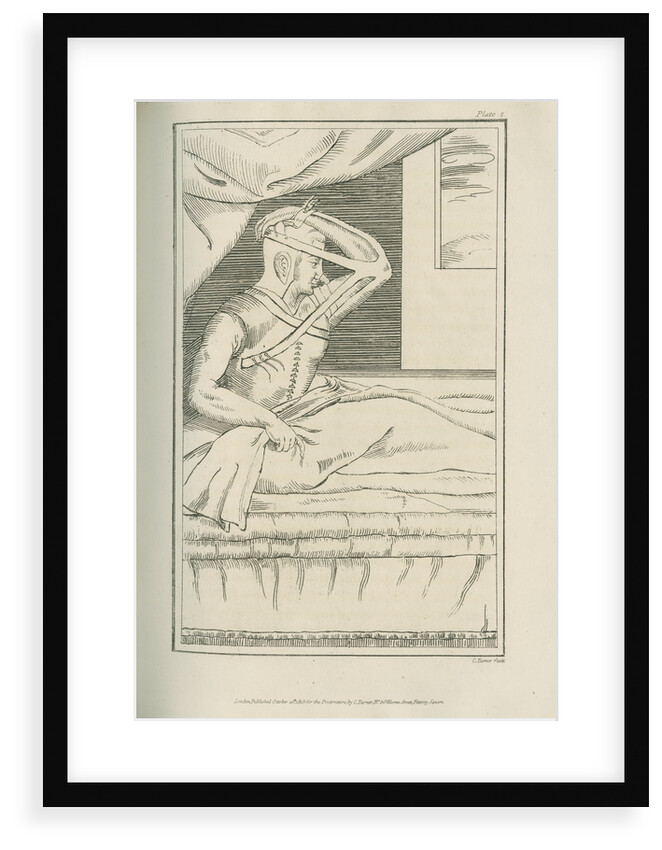 The Italian method of nose replacement by Charles Turner