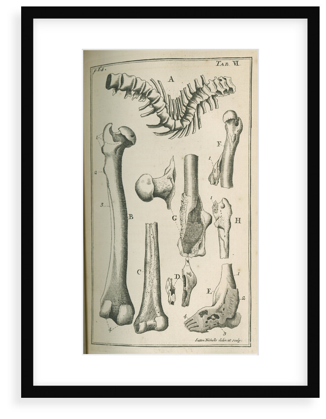 Various human bones by Sutton Nicholls