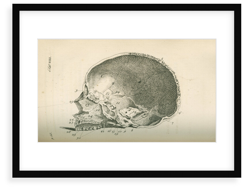 The inside of a skull sawed longitudinally by unknown
