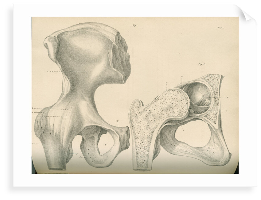 Hip bone and a portion of the femur by J Perry