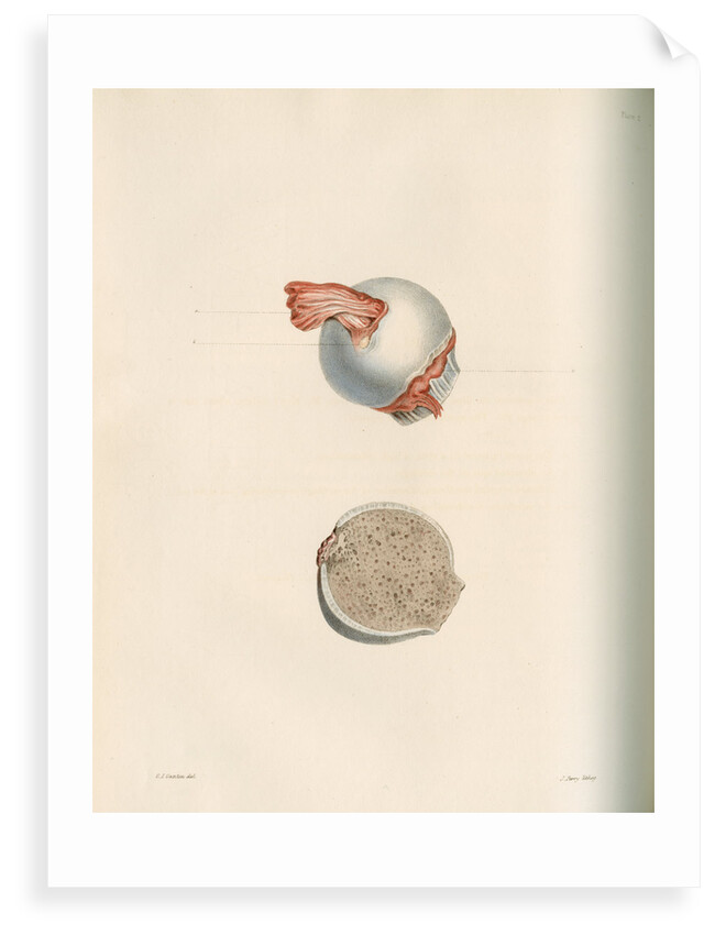 The head of the femur by J Perry