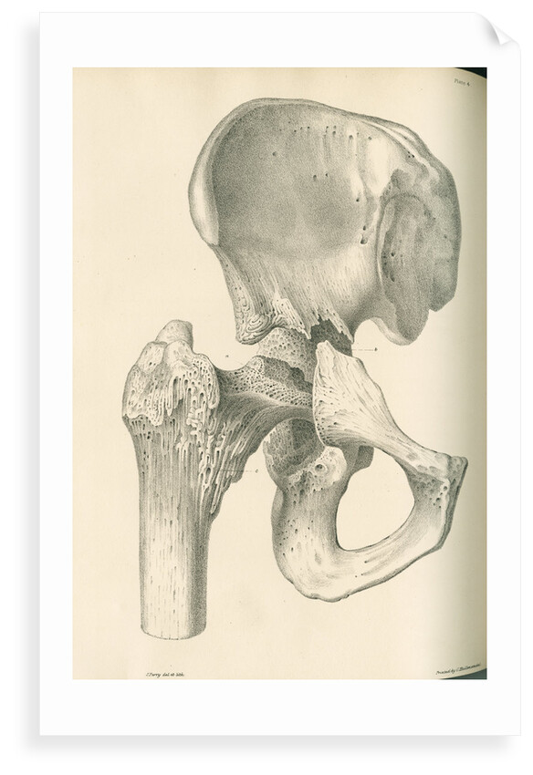 Front view of the right hip and femur by J Perry