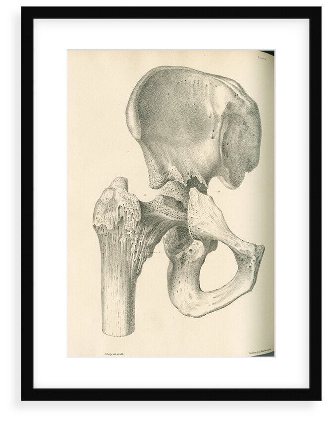 Front view of the right hip and femur by J Perry