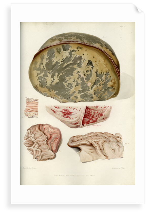 Parts of the brain including the dura mater by William Say