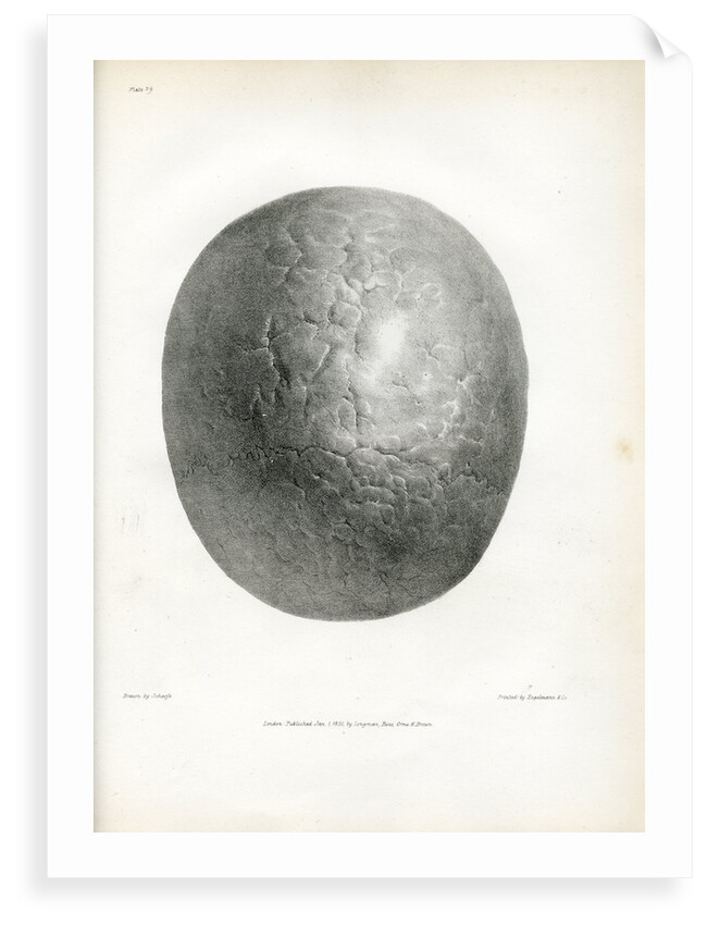 'Epilepsy' by Godefroy Engelmann