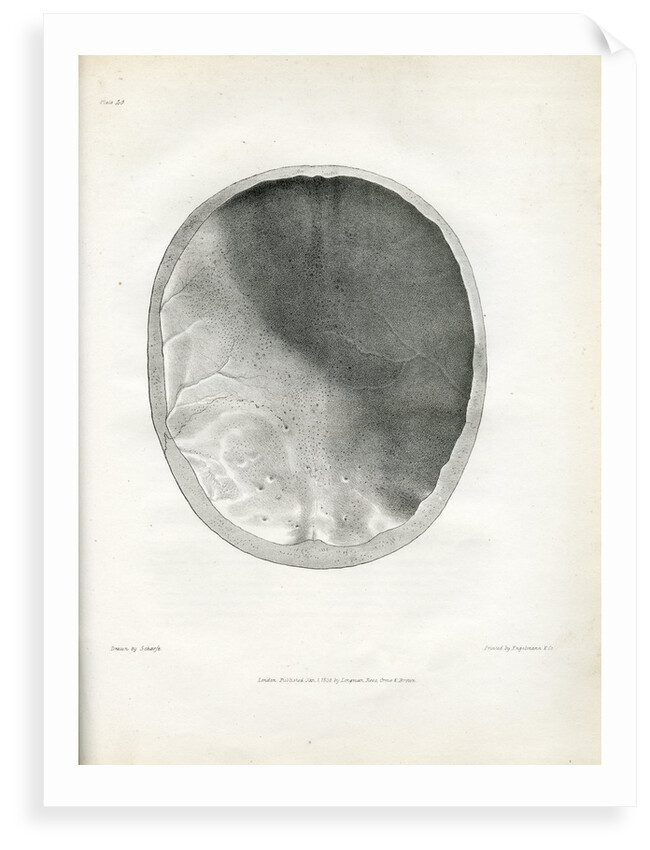 'Epilepsy' by Godefroy Engelmann