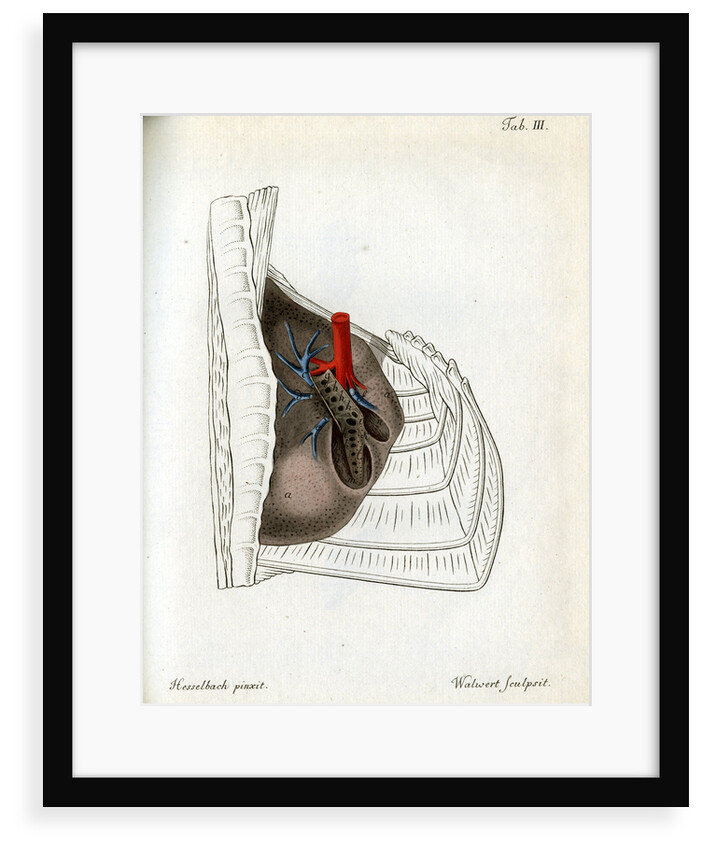Lungs and pulmonary artery by Walwert