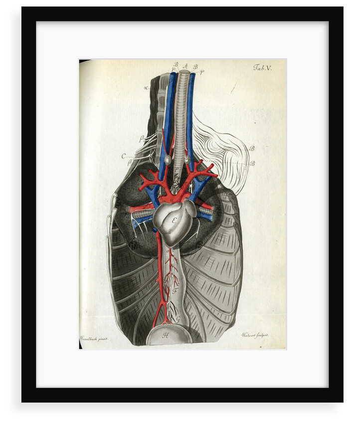 View of the chest cavity by Walwert