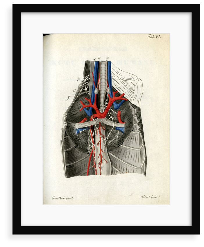 Open chest cavity by Walwert