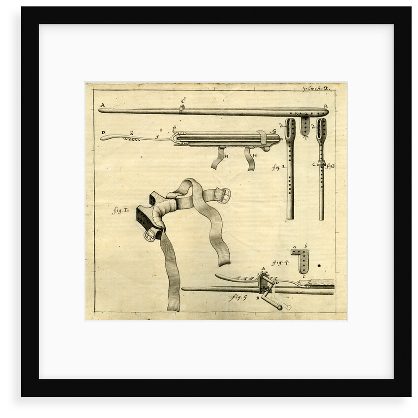 Components of the 'Ambe of Hippocrates': contraption for repairing dislocated shoulders by Claude-Nicholas Le Cat