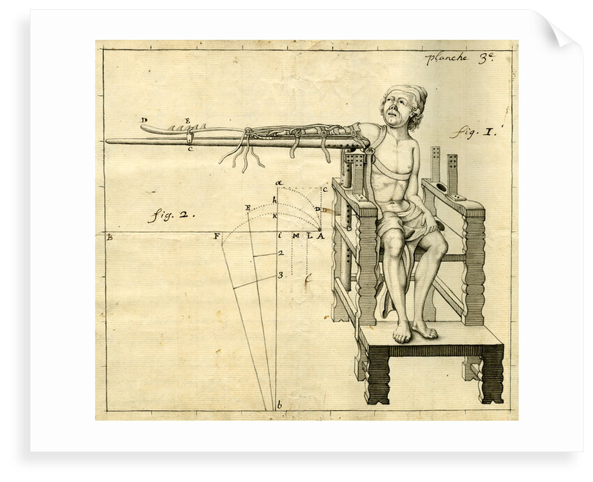'Ambe of Hippocrates': contraption for repairing dislocated shoulders by Claude-Nicholas Le Cat