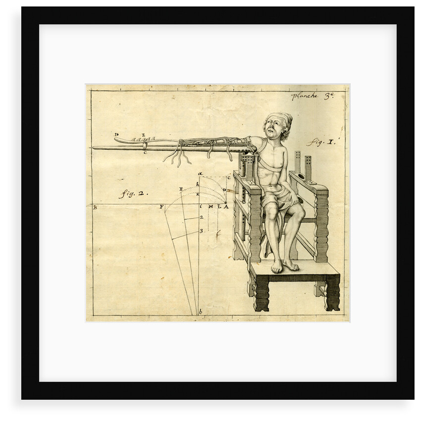 'Ambe of Hippocrates': contraption for repairing dislocated shoulders by Claude-Nicholas Le Cat