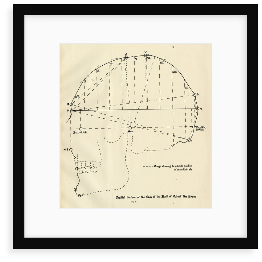 Measurements of Robert the Bruce's skull by unknown