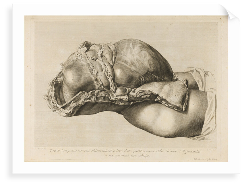 Human gravid uterus by II Scotin