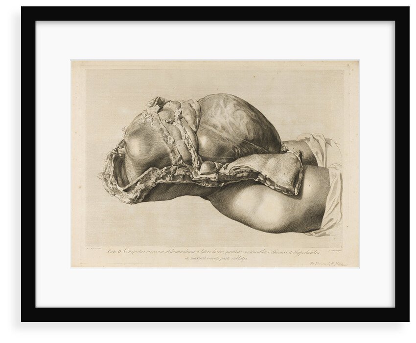 Human gravid uterus by II Scotin